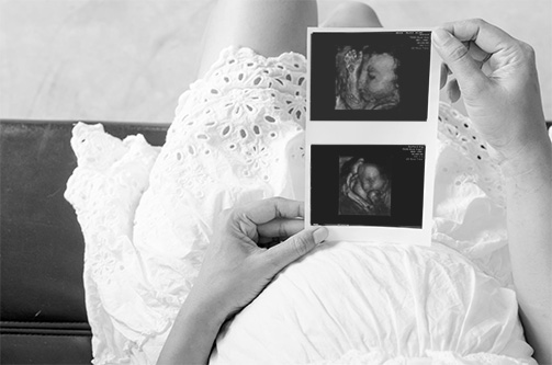 pregnant woman holding soundscans of baby